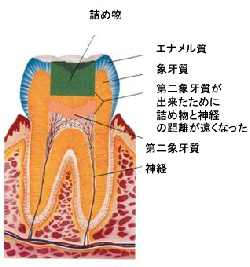 治療後しばらく時間経過後