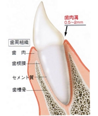 健康な歯周組織